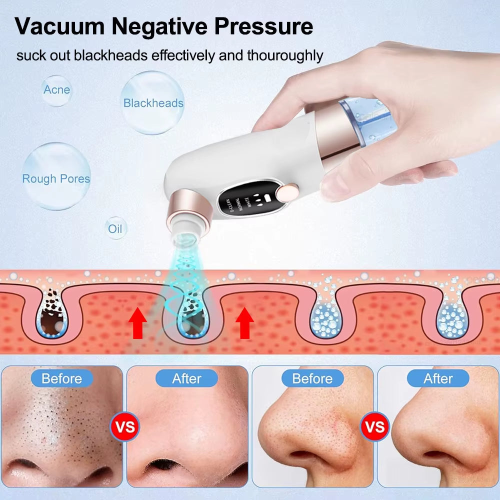 Electric Blackhead Remover Pore Vacuum Cleaner Facial Black Dots Vacuum Cleaner Pimple Acne Blackhead Removal Black Dots Remover
